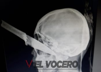 Máxima crueldad: la joven atacada con un cuchillo lucha por su vida