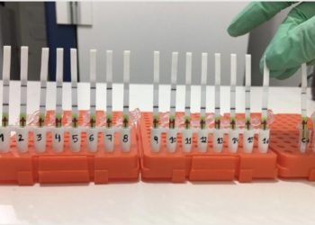 Un grupo de argentinos creó un método para detectar el coronavirus en 60 minutos