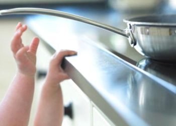 Las quemaduras lideran los accidentes caseros en cuarentena: ¿Cómo actuar y prevenirlas?