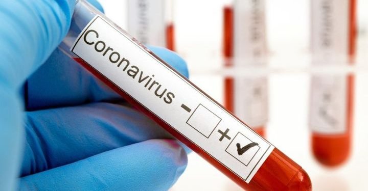 En aumento: Se notificaron 335 nuevos casos de coronavirus en Salta